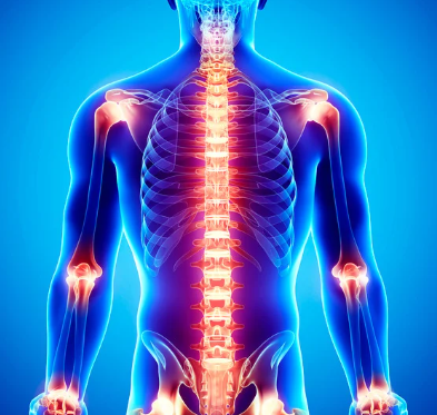 qu'est ce que les troubles musculo squelettiques?
