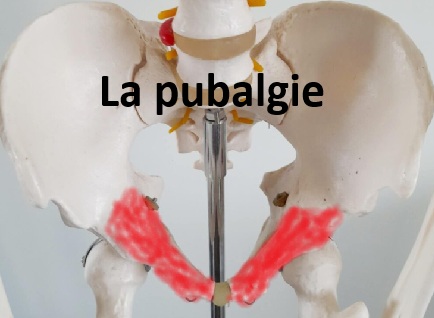 la pubalgie