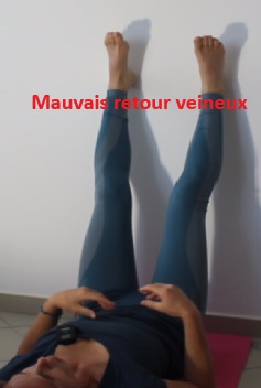 mauvais retour veineux