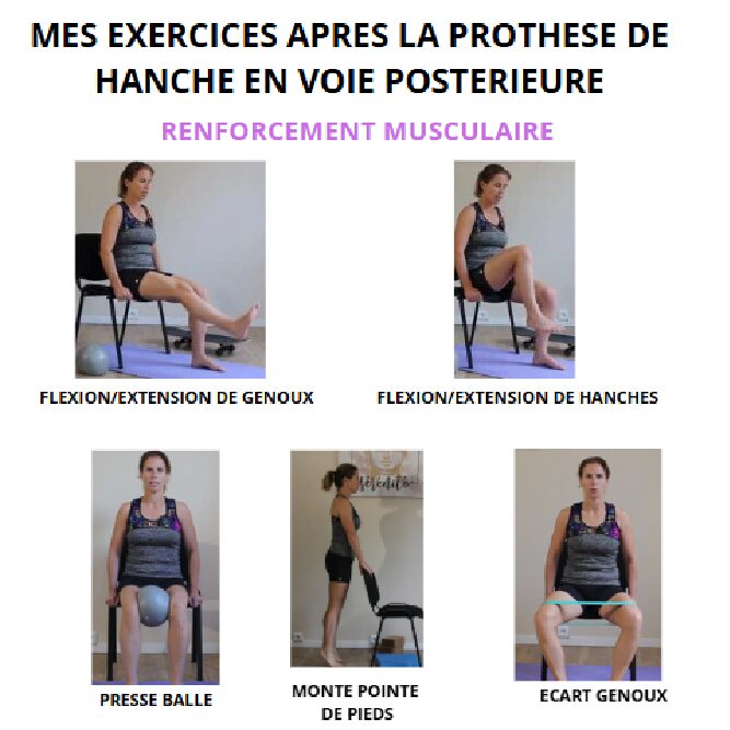 PDF FORMAT A2 EXERCICES APRES UNE PROTHESE DE HANCHE PAR VOIE POSTERIEURE A TELECHARGER